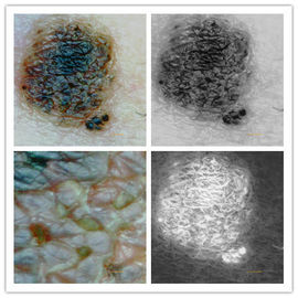 5M पिक्सेल के रिज़ॉल्यूशन के साथ त्वचा निरीक्षक डिजिटल माइक्रोस्कोप त्वचा विश्लेषक त्वचा और स्कैल्प कैमरा