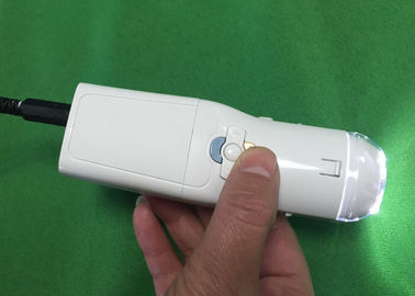 योनी कैमरा डिजिटल इलेक्ट्रॉनिक colposcope गर्भाशय ग्रीवा के रोगी को खोजने के लिए Eealier
