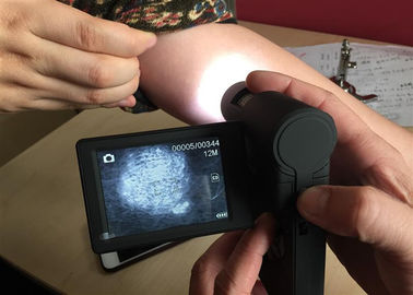 3 इंच टीएफटी कलर रोटेटेबल डिस्प्ले के साथ वीडियो स्किन माइक्रोस्कोप पोर्टेबल डर्मेटोस्कोप