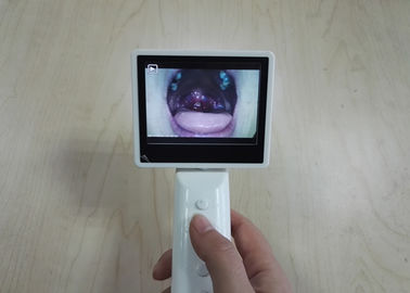 एसडी कार्ड स्टोरेज ईएनटी डायग्नोस्टिक उपकरण ओटोस्कोप ओफ्थाल्मोस्कोप स्वचालित रूप से यूएसबी केबल के साथ
