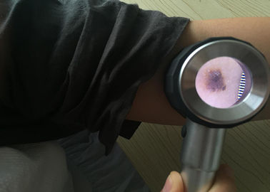 त्वचा निरीक्षण के लिए अनुकूलित स्वास्थ्य देखभाल हैंडहेल्ड मेडिकल डर्माटोस्कोप डिजिटल वीडियो ओटोस्कोप