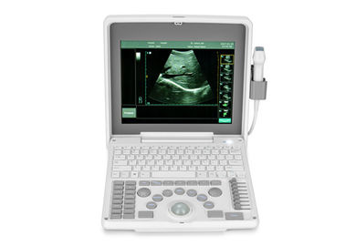 डिजिटल पोर्टेबल मोबाइल लैपटॉप अल्ट्रासाउंड स्कैनर चिकित्सा उपकरण BIO 3000J के साथ 1.12 इंच एलईडी स्क्रीन