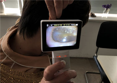 उच्च रिज़ॉल्यूशन के साथ हैंडहेल्ड डिजिटल वीडियो ओटोस्कोप डर्मेटोस्कोप ऑप्थाल्मोस्कोप