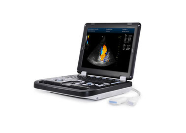 15 इंच पूर्ण डिजिटल पोर्टेबल अल्ट्रासाउंड स्कैनर मेडिकल अल्ट्रासोनिक नैदानिक ​​उपकरण