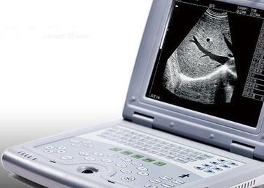 गर्भावस्था के लिए पोर्टेबल अल्ट्रासाउंड मशीन पोर्टेबल अल्ट्रासाउंड स्कैनर केवल 2.2kgs वजन