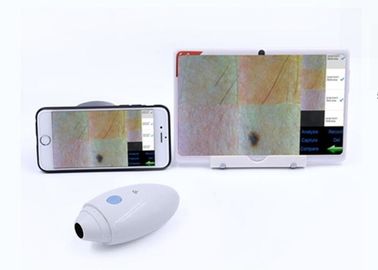 एचडी डिजिटल वीडियो डर्मेटोस्कोप स्किन हेयर स्कैनर वायरलेस मोबिलोफोन सपोर्टेड आईओएस एंड्रियोड से जुड़ा