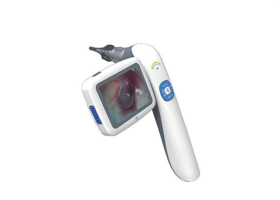 यूएसबी वीडियो ओटोस्कोप वीडियो ओटोस्कोपी मेडिकल एंडोस्कोप डिजिटल कैमरा सिस्टम फोटो और वीडियो रिकॉर्ड के साथ
