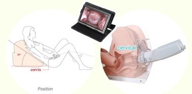 हेल्थकेयर उत्पाद स्त्रीरोगों एंडोस्कोपिक डिजिटल इलेक्ट्रॉनिक Colposcope महिला घरेलू उपयोग के लिए