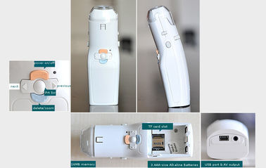 हैंडहेल्ड मिनी सेल्फ-इंस्पेक्टर डिजिटल इलेक्ट्रॉनिक Colposcope योनि वीडियो कैमरा केवल 10g वजन