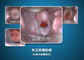 एवी यूएसबी आउटपुट गर्भाशय ग्रीवा और वाजिन के लिए डिजिटल इलेक्ट्रॉनिक कलपोस्कोप सेल्फ इंस्पेक्शन डिवाइस