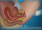 एवी यूएसबी आउटपुट गर्भाशय ग्रीवा और वाजिन के लिए डिजिटल इलेक्ट्रॉनिक कलपोस्कोप सेल्फ इंस्पेक्शन डिवाइस