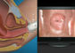 हाई डेफिनिशन वीडियो गायनोकोलॉजिकल एप्लायंसेज डिजिटल इलेक्ट्रॉनिक कोलपोस्कोप एवी / यूएसबी आउटपुट