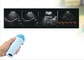 हैंडहेल्ड ब्लैडर पोर्टेबल स्कैनर माइक्रो उत्तल जांच अल्ट्रासाउंड पशु चिकित्सा गर्भावस्था