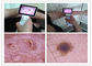 रंग TFT एलसीडी यूएसबी ओटोस्कोप के साथ मानव शरीर डिजिटल वीडियो ओटोस्कोप का नैदानिक ​​ईएनटी निरीक्षण