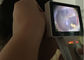 ईएनटी एंडोस्कोप डिजिटल वीडियो ओटोस्कोप एसडी कार्ड आउटपुट यूएसबी ओटोस्कोप के साथ पूर्ण डिजिटल निरीक्षण