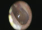 रंग TFT एलसीडी यूएसबी ओटोस्कोप के साथ मानव शरीर डिजिटल वीडियो ओटोस्कोप का नैदानिक ​​ईएनटी निरीक्षण
