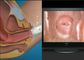 हाई डेफिनिशन वीमेन सेल्फ-एग्जामिनेशन एंडोस्कोप एवी (वीडियो) सिग्नल डिजिटल इलेक्ट्रॉनिक कोलपोस्कोप