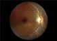 ऑटो फोकस मेडिकल वीडियो Ophthalmoscope FOV 45 ° के साथ