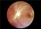 ऑटो फोकस मेडिकल वीडियो Ophthalmoscope FOV 45 ° के साथ