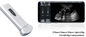 म्यूटिल भाषा भ्रूण रंग डॉपलर अल्ट्रासाउंड स्कैनर माइक्रो - उत्तल जांच के साथ