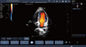 म्यूटिल भाषा भ्रूण रंग डॉपलर अल्ट्रासाउंड स्कैनर माइक्रो - उत्तल जांच के साथ