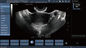 ट्रांसवजाइनल जांच रंग डॉपलर अल्ट्रासाउंड स्कैनर, हाथ में डॉपलर गर्भावस्था