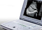 गर्भावस्था के लिए पोर्टेबल अल्ट्रासाउंड मशीन पोर्टेबल अल्ट्रासाउंड स्कैनर केवल 2.2kgs वजन