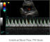 12.1 इंच एलईडी मॉनिटर और 2 जांच पोर्ट के साथ रंगीन डॉपलर अल्ट्रासाउंड सिस्टम पोर्टेबल अल्ट्रासाउंड स्कैनर
