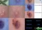 त्वचा और स्कैल्प डिटेक्टर वीडियो मॉइस्चराइजर मॉइस्चर ऑइल पिगमेंट फ्लेक्सिबल की रिपोर्ट के साथ डर्मेटोस्कोप