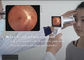 नेत्र रोगों के लिए नेत्र निदान डिजिटल फंडस कैमरा उपकरण
