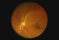 Ophthalmoscope पोर्टेबल हैंडहेल्ड फंडस कैमरा टेलीमेडिसिन उपलब्ध वीडियो रिज़ॉल्यूशन 1280 X 960 पिक्सेल