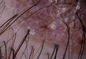 3 घंटे के लिए वाईफ़ाई त्वचा वीडियो डर्मेटोस्कोप 2.5 डब्ल्यू