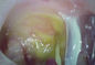 यूएसबी वीडियो ओटोस्कोप वीडियो ओटोस्कोपी मेडिकल एंडोस्कोप डिजिटल कैमरा सिस्टम फोटो और वीडियो रिकॉर्ड के साथ
