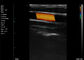 इको हैंडहेल्ड कलर डॉपलर लाइनर स्कैन कैरोटिड आर्टरी 7.5-10MHz फ्रीक्वेंसी