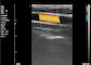 गर्भावस्था के लिए रंगीन अल्ट्रासाउंड मशीन होम अल्ट्रासाउंड स्कैनर पोर्टेबल अल्ट्रासाउंड 8 TGC 3.5 ~ 10 MHz