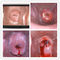 योनी कैमरा डिजिटल इलेक्ट्रॉनिक colposcope गर्भाशय ग्रीवा के रोगी को खोजने के लिए Eealier