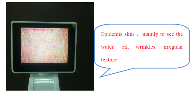 डॉक्टर के लिए CE BS5SH डिजिटल त्वचा विश्लेषक डिजिटल त्वचा नमी मीटर