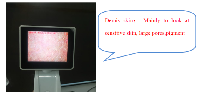 डॉक्टर के लिए CE BS5SH डिजिटल त्वचा विश्लेषक डिजिटल त्वचा नमी मीटर