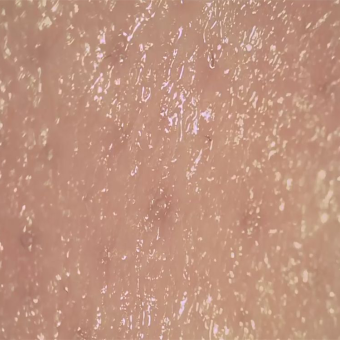 त्वचा नमी डिटेक्टर वायरलेस डिजिटल त्वचा विश्लेषक त्वचा की त्वचा के छिद्रों की सतह के संरक्षण के लिए