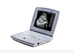 बाल चिकित्सा के लिए पोर्टेबल बेबी अल्ट्रासाउंड मशीन पोर्टेबल अल्ट्रासाउंड स्कैनर