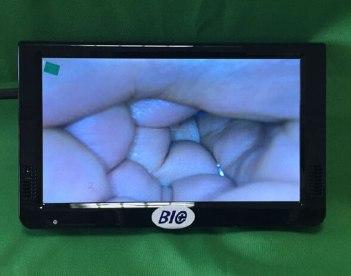 पोर्टेबल डिजिटल इलेक्ट्रॉनिक कोलपोस्कोप