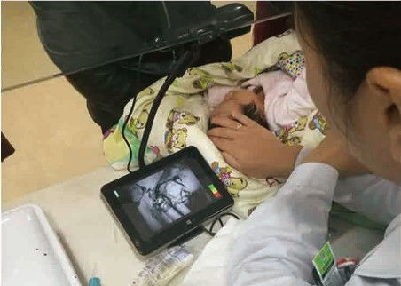 पोर्टेबल किफायती इन्फ्रारेड नस खोजक का पता लगाने के बारे में 10 मिमी गहराई नस ट्रॉली उपलब्ध है