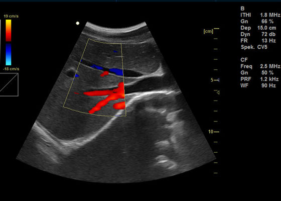 15 इंच पूर्ण डिजिटल पोर्टेबल अल्ट्रासाउंड स्कैनर मेडिकल अल्ट्रासोनिक नैदानिक ​​उपकरण