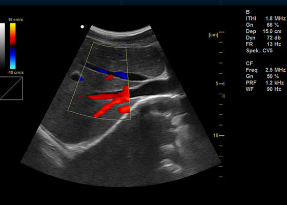 15 इंच पूर्ण डिजिटल पोर्टेबल अल्ट्रासाउंड स्कैनर मेडिकल अल्ट्रासोनिक नैदानिक ​​उपकरण