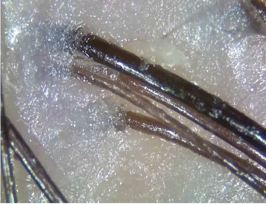 ध्रुवीय प्रकाश के साथ पोर्टेबल वायरलेस डिजिटल त्वचा विश्लेषक टेलीमेडिसिन निदान डिवाइस