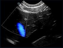 मिनी पॉकेट हैंडहेल्ड अल्ट्रासाउंड स्कैनर कलर डॉपलर जांच 2 ~ 11MHz की आवृत्ति के साथ बदलने योग्य
