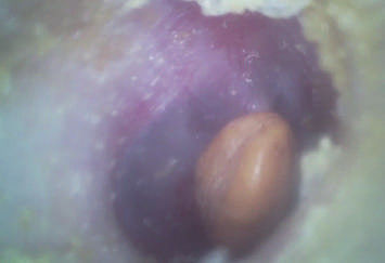 32G के माइक्रो एसडी फ्लैश कार्ड के साथ पोर्टेबल ईएनटी स्कोप आर्थिक हाथ में डिजिटल वीडियो ओटोस्कोप