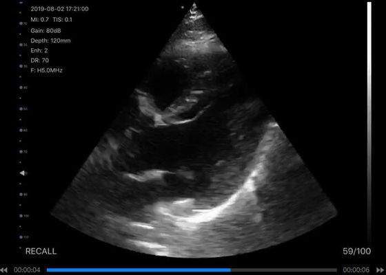 डिजिटल वायरलेस हैंडहेल्ड अल्ट्रासाउंड स्कैनर