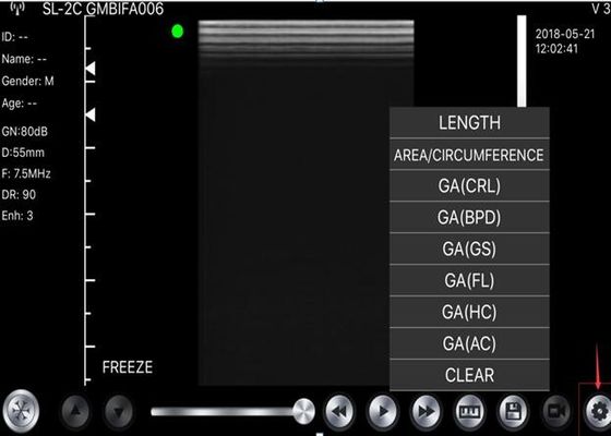 5G हैंडहेल्ड अल्ट्रासाउंड स्कैनर उत्तल: 3.5 ~ 5MHz, रैखिक: 7.5 ~ 10MHz, हृदय: 2.5 ~ 5MHz