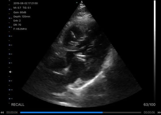 5G हैंडहेल्ड अल्ट्रासाउंड स्कैनर उत्तल: 3.5 ~ 5MHz, रैखिक: 7.5 ~ 10MHz, हृदय: 2.5 ~ 5MHz